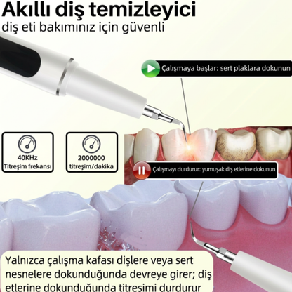 Elektrikli Diş Taşı Temizleyici