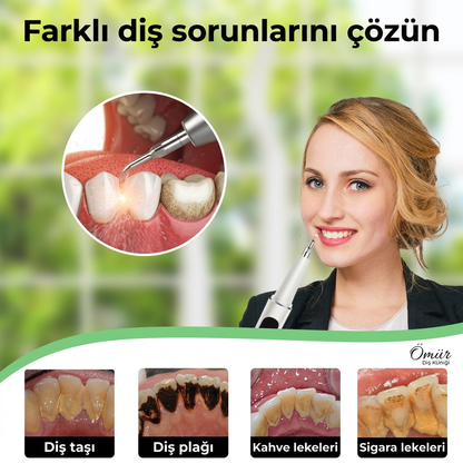 Elektrikli Diş Taşı Temizleyici